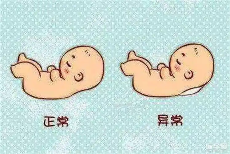 孕12周nt暗示男女95准确率机不可失