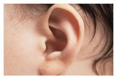 耳朵小的人没福气吗_耳垂小耳朵薄没福气2022已更新