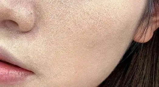 告别干燥,迎接水润!超补水护肤秘籍来啦!