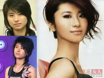 尚雯婕整容前后照片 大饼脸变瓜子脸