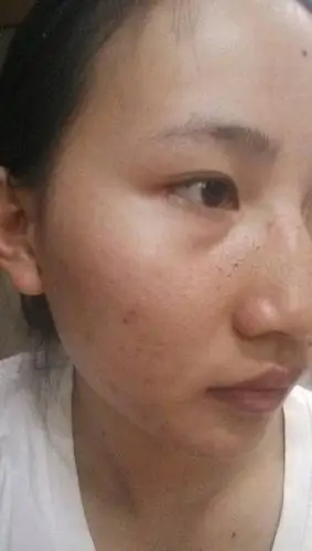 脸上和手上的皮肤变的暗黄无光泽了是怎么回事