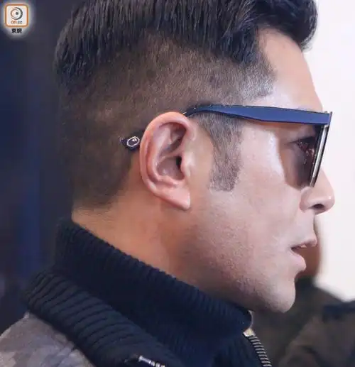 omg古天乐眼球穿洞要缝8针侧面拍到他的眼睛超可怕到现在都不知道视力