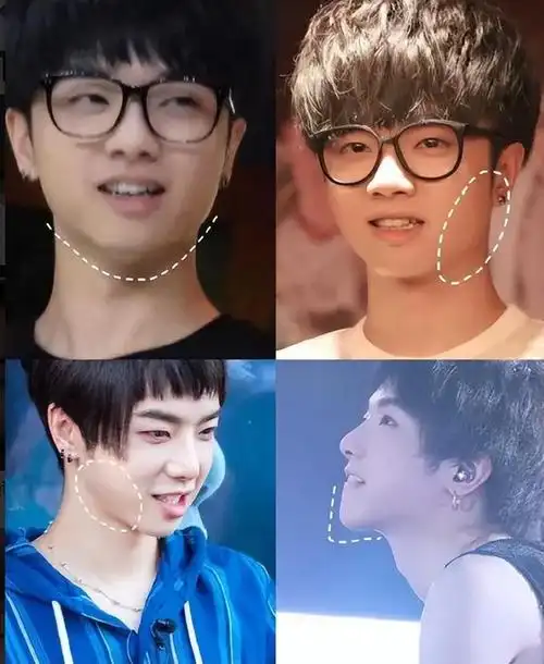 整容前后判若两人却自称是天然脸真当观众看不出吗