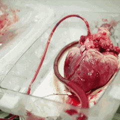 求一个心脏跳动的动态图 要真识!不要卡通!霸气的!一个大心脏在扑通扑