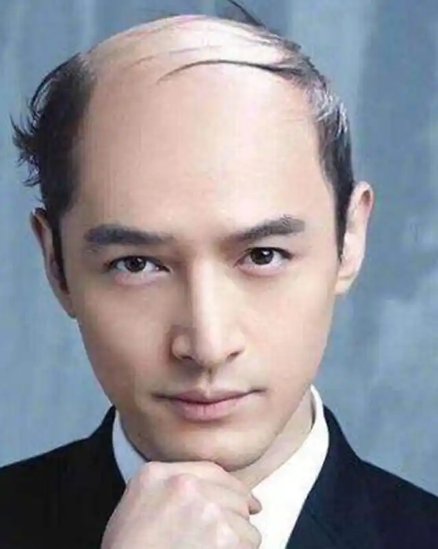 盘点娱乐圈被恶搞成秃头的明星,林更新帅气,而他是男人的最爱