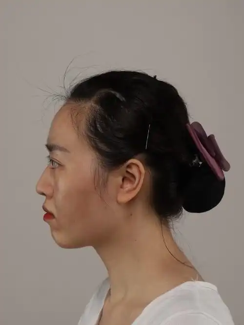 为什么神仙姐姐驼峰鼻好看你却不好看