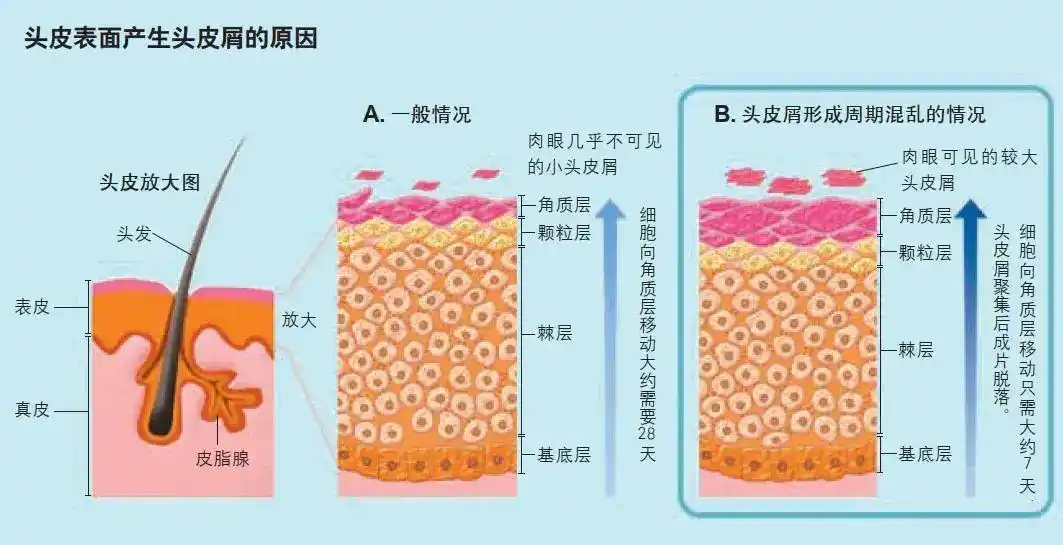 头皮屑|角质层|洗发液_新浪新闻