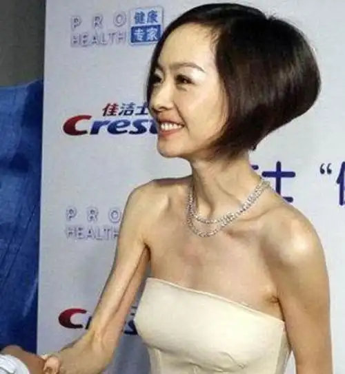 大头娃娃鲁豫不再"皮包骨",增肥30斤后,漂亮