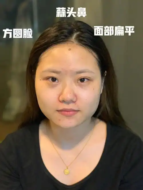 方圆脸蒜头鼻面部扁平的看过来