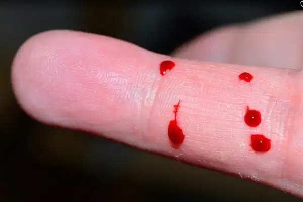 电视剧里的滴血认亲你信吗