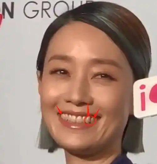 45岁马伊俐生图曝光一口黄牙污垢明显网友好恶心