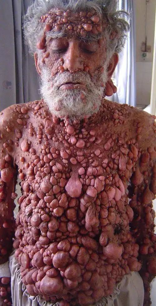 这人是谁?他怎么能活到这个地步?什么病啊?