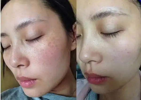 美白去黄护肤品排行榜,榜单前三,好用不贵