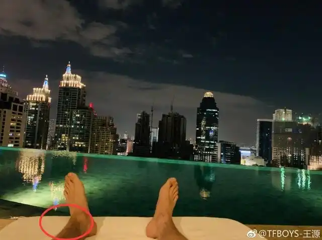 王源真的长大了发自拍腿毛太浓密粉丝调侃像钢丝球