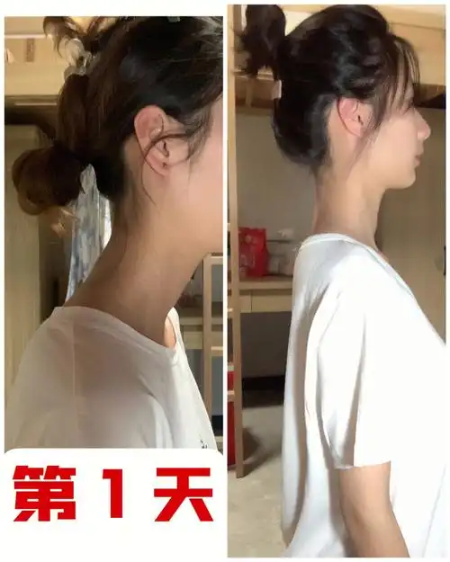 每天五分钟有效改善脖子前倾
