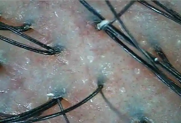 你的头皮属于哪种类型?_手机搜狐网