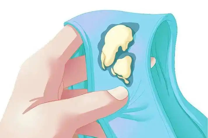 作为女性在非经期的阴道分泌物,白带的增加或减少,性状,气味,颜色等的