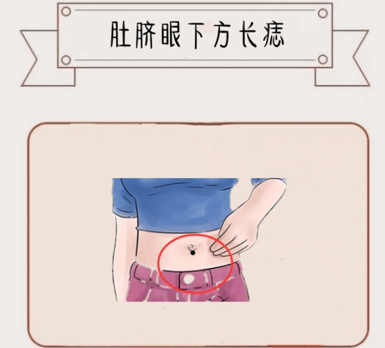 身体5颗"暗财"痣,颗颗藏黄金,藏而不漏,个个财大气粗!