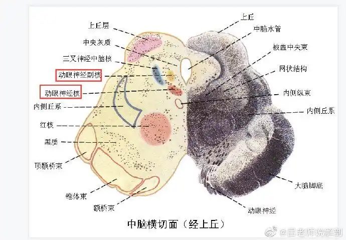 脑干8个不同水平切面:主要观察脑神经定位. 来自吕老师说解剖 - 微博