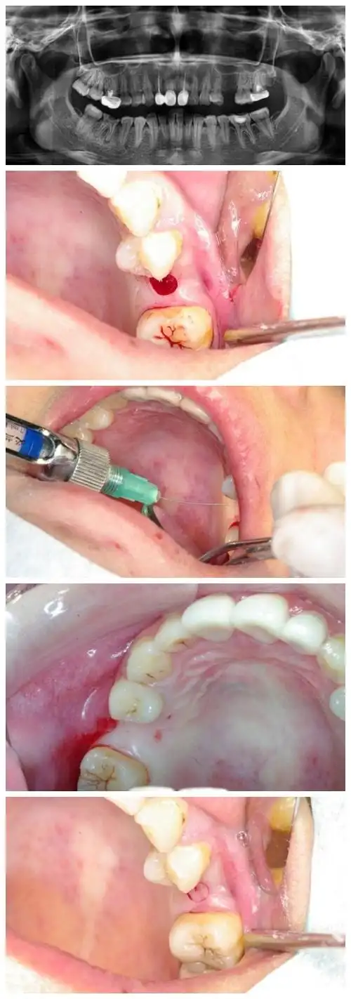 口腔主治医师,同济大学口腔医学硕士,美国牙科协会(ada)会员,国际种植