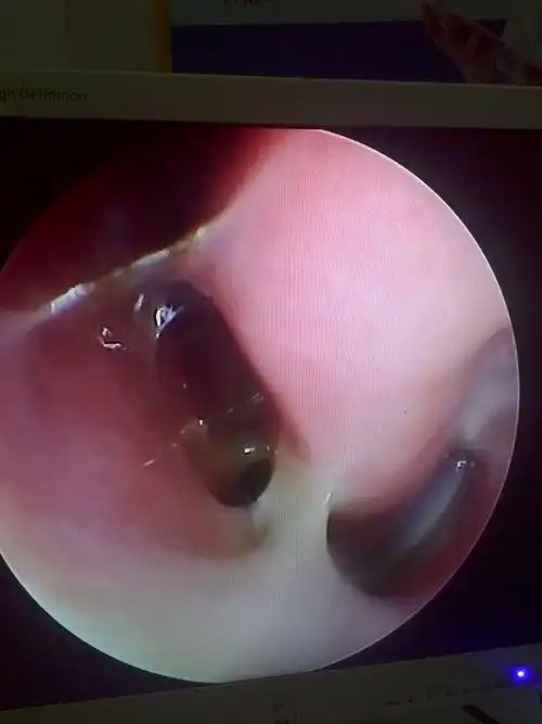 鼻炎,鼻窦炎,疱疹专科. 刘医生,电话15532870379(副本)