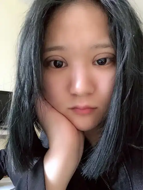 大家帮我看看我的双眼皮是不是割的太宽了,后悔死了,_圈子-新氧美容