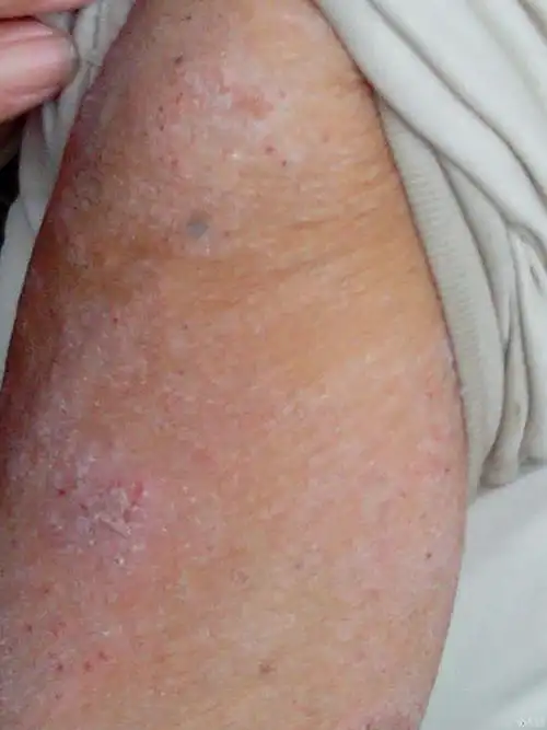 请各位专家老师会诊指教不胜感谢