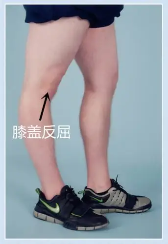 2,腿绷直,膝盖会有反屈的情况,每条腿1分1,拇指弯到小臂处,每只手1分