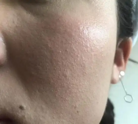 婚后肌肤缺水的女人脸上有3个表现一定要重视不要后悔莫及