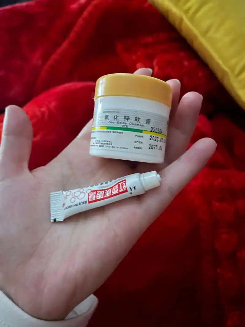 红屁股神药 氧化锌软膏77红霉素眼膏简直是红屁股神药,宝宝红屁股反