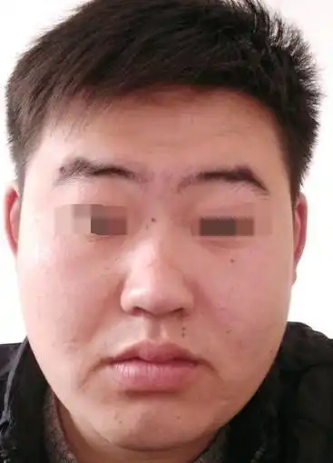 山根有横纹的人,十有八九婚姻不顺