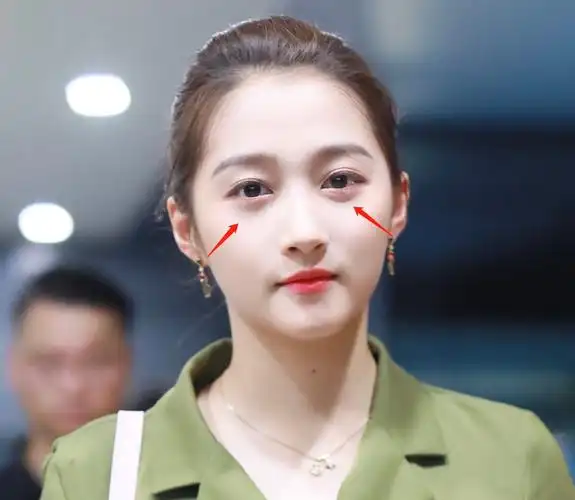 关晓彤和周洁琼撞衫被嘲,肤白貌美大长腿的她为什么这么惨?