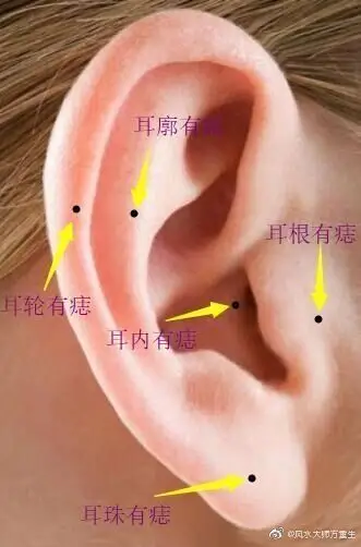 耳朵长痣除了耳根都是不错的痣,不同的地方也有不同的寓意!
