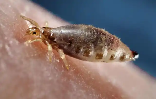 虱子有何危害?几十年前人人身上都有的虱子,为何现在看不到了?