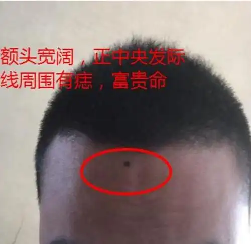 这些地方长毛的男人,命中注定长寿又富贵,40之后必大赚