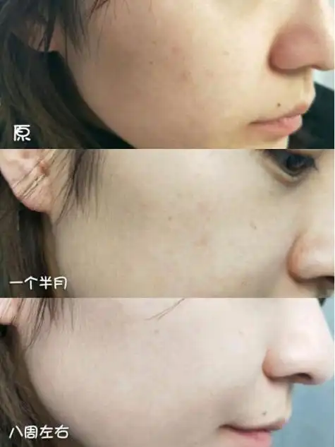 美白祛斑的护肤品哪个品牌好?这3款产品效果惊人!