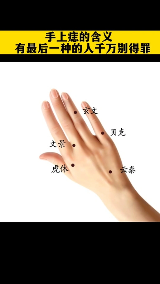 右手手背痣分布图_右手手背正中间有颗痣_右手手背长红痣 - 抖音