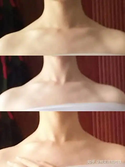 如何判断自己斜方肌是否发达