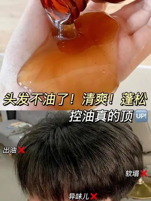 开挂的控油洗发水头发不油也不臭了
