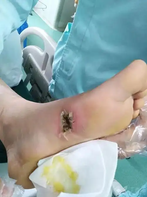 有图有真相 | 「电击」真的伤_患者