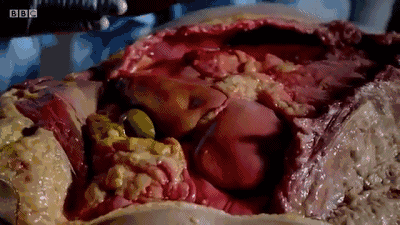 从没像现在这么惧怕肥胖,给胖子的最后一个警示!