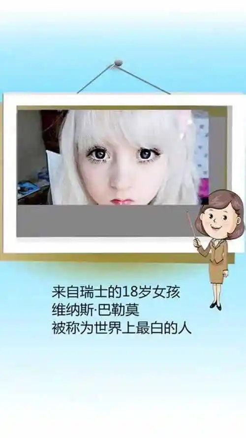 世界上最白的人,来自瑞士的一位18岁女孩
