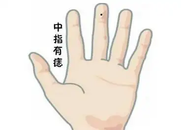 左手中指长了一颗痣是什么意思 左手中指有痣最有福气