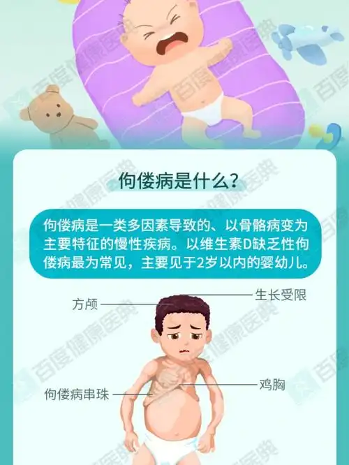 幼儿佝偻病很常见,很多孩子都有!(一)
