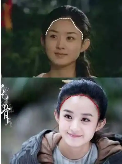 赵丽颖早期出道时的照片和现在的照片对比精致了很多,_圈子-新氧美容