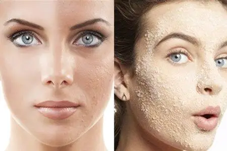 毛孔粗大皮肤很粗糙怎么办 做好清洁帮你拥有细腻肌肤