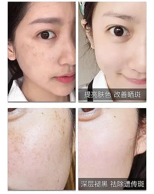 盘点十大美白排行榜,这几款值得信赖|祛斑|色斑|熊果苷|收缩毛孔|敏感