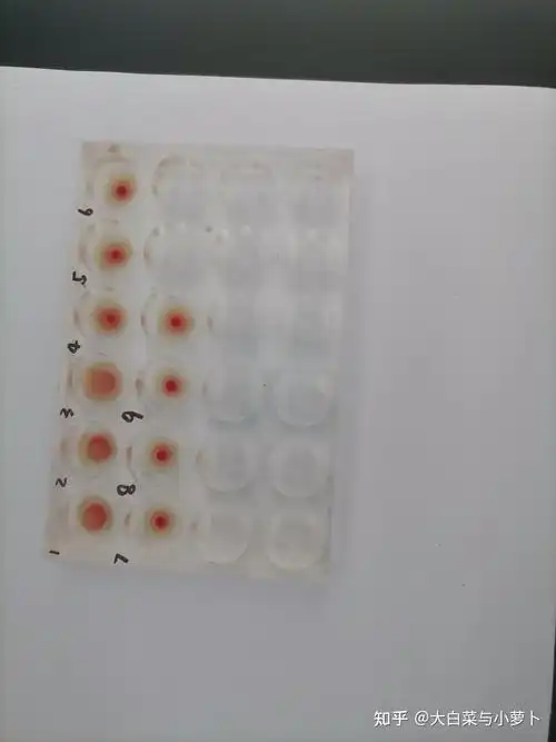 微生物实验流感病毒红细胞凝集实验肥达试验