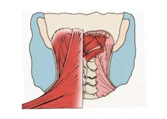 枕下肌群-提醒醒脑抗疲劳,脊背部的功能中心