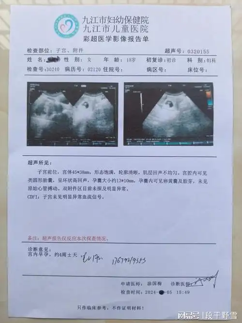 刚怀孕一个月怎么打掉三个月的胎儿能打掉吗刚刚怀孕10天怎么打掉